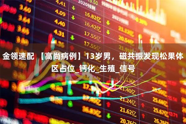 金领速配 【高尚病例】13岁男，磁共振发现松果体区占位_钙化_生殖_信号